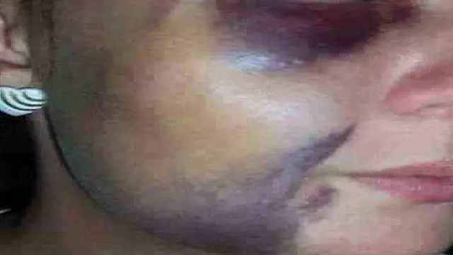 Mulher é espancada com porrete pelo marido