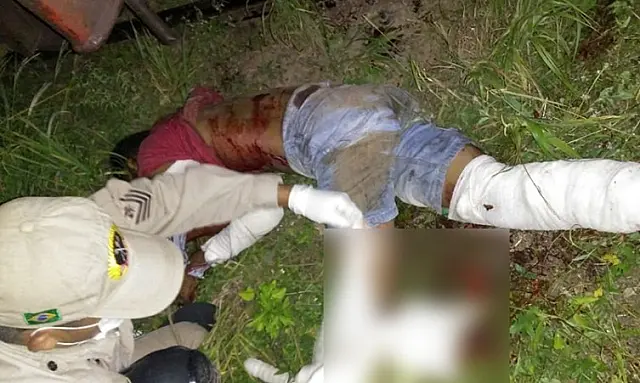 Após ser atropelado por locomotiva, homem tem perna amputada