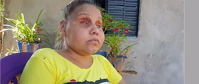Diabética e cega, jovem de Anastácio quer ajuda para fazer consulta e conseguir transplante
