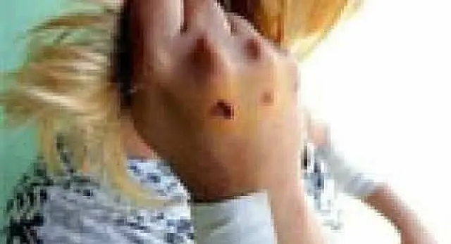 Jovem é agredida a socos e puxões de cabelo pela ex-namorada em Aquidauana