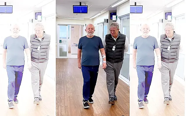 Lula deixa UTI e passa a ter cuidados semi-intensivos no hospital