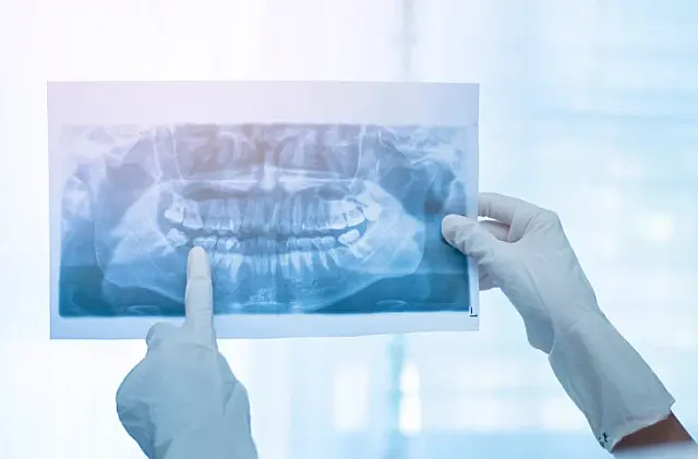 Dez municípios de MS devem oferecer raio-X panorâmico odontológico