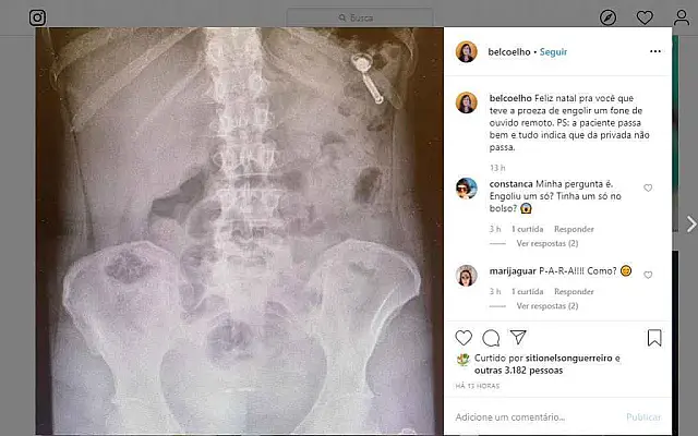 Ao invés de vitamina, chef engole fone de ouvido