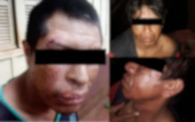 Polícia investiga agressão de grupo armado a indígenas em fazenda