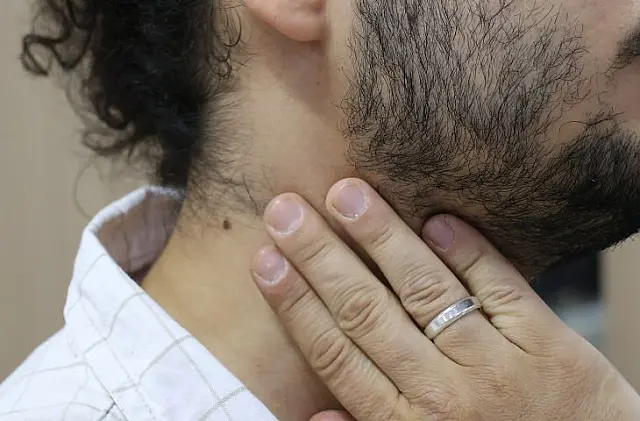 Ações de prevenção do Câncer de Cabeça e Pescoço são reforçadas
