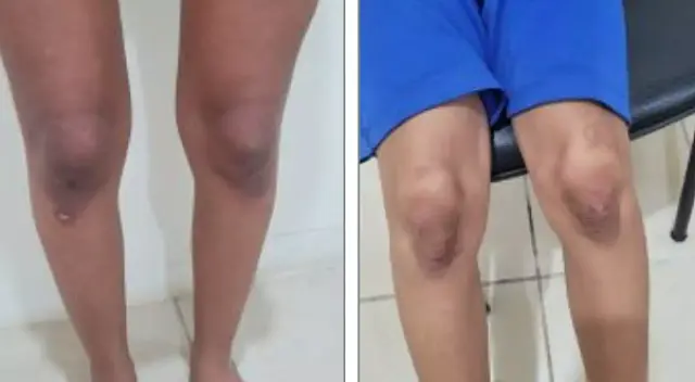 Mãe e namorada são presas por tortura de criança e adolescente em MS