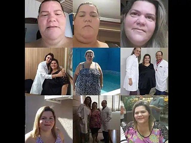 Após cirurgia bariátrica, aquidauanense comemora perda de 48 quilos