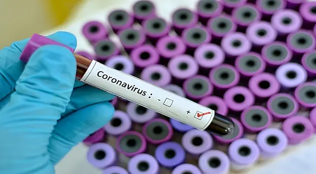 Covid-19: Brasil tem 2º dia com maior registro de novos casos