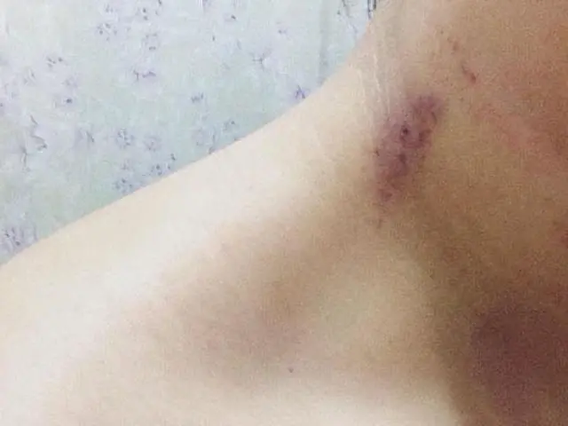 Em pleno expediente, mulher leva 'chupão' de colega de trabalho