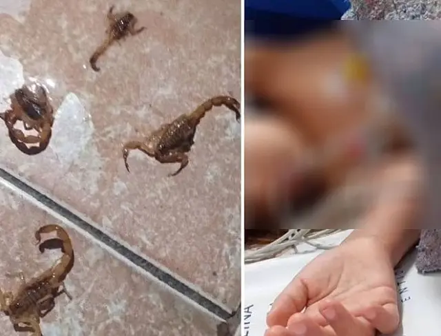 Menino de 8 anos, picado por escorpião em Ribas do Rio Pardo, tem alta