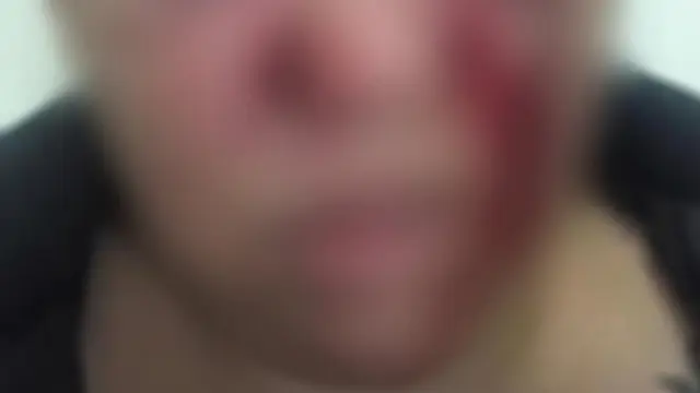 Enquanto enchia pneu, compressor de ar estoura e homem é atingido
