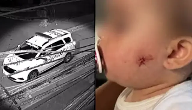 PM atira em rosto de bebê de 1 ano com arma de airsoft
