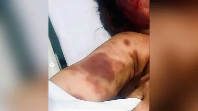 Menina de 13 anos é encontrada bêbada, com traumas de acidente e estupro