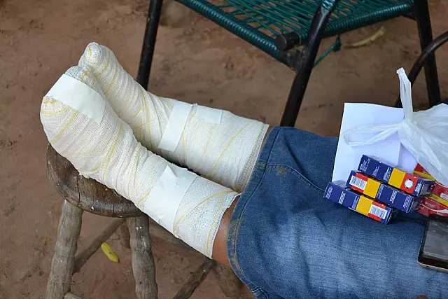 Vítima de 57 anos fazia almoço quando teve início incêndio em botijão