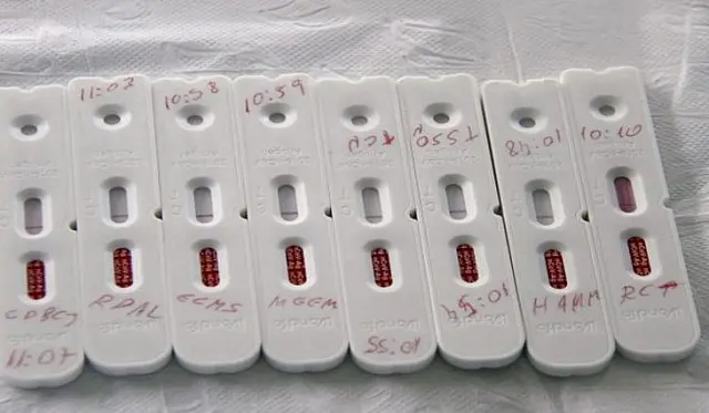 SES registra 1,2 mil novos casos Covid nesta segunda-feira