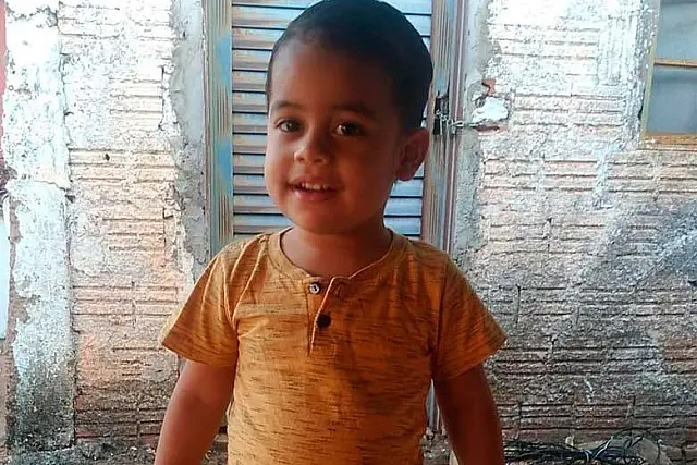 Criança é internada após sofrer queimadura e família faz apelo