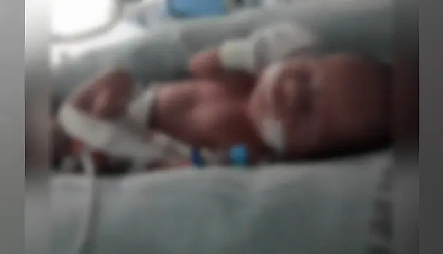 Bebê cai de cama, demora a ser socorrido e morre em unidade de saúde