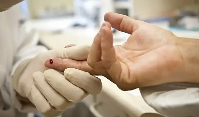 Casos de sífilis e de HIV/aids aumentam entre homens jovens