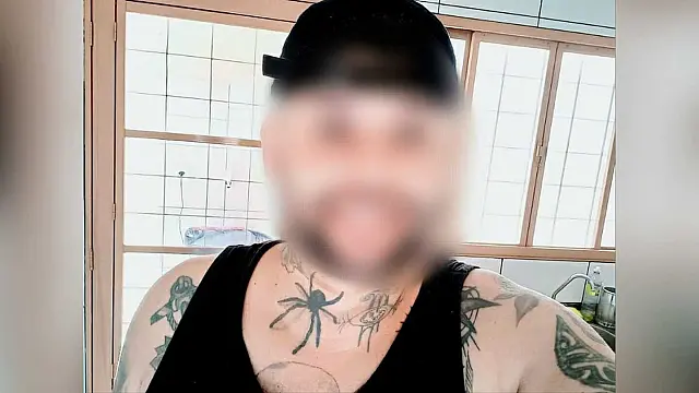 Médico confirma cegueira de tatuador atingido por soda cáustica