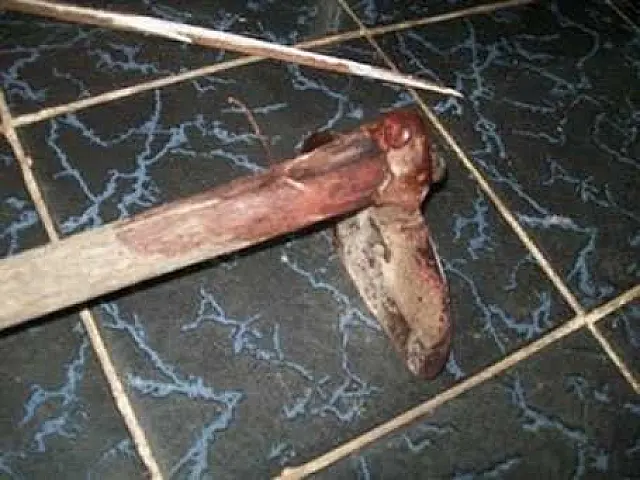 Briga entre irmãos termina com mulher gravemente ferida a golpe de enxada