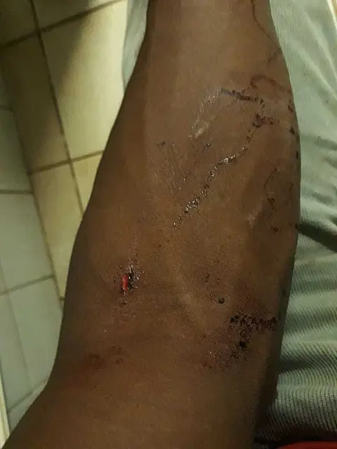 Haitiano é agredido por brasileiro e relata maus tratos na Capital
