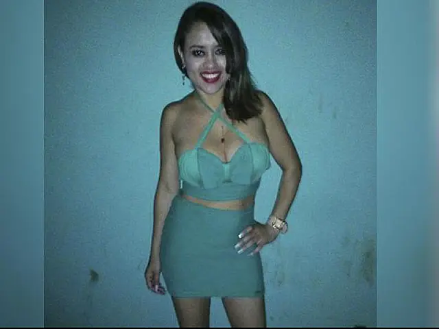 'Ela gostava de dançar': família de jovem que perdeu a perna em acidente lamenta tragédia