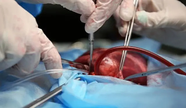 Setembro Verde: em MS, 428 pessoas esperam por transplante de órgãos