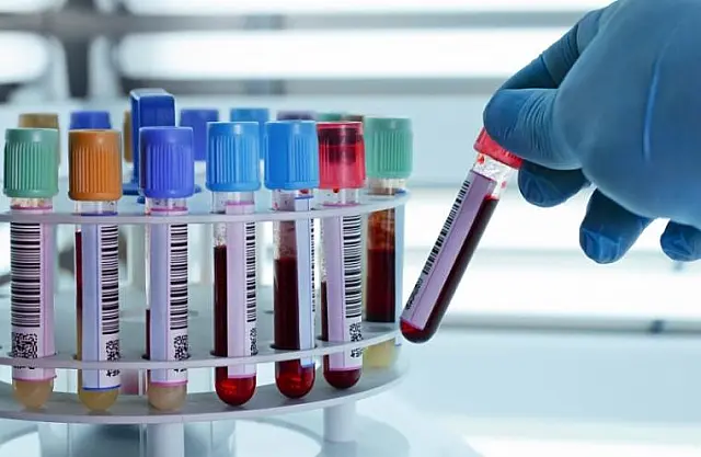 Secretaria de Saúde retoma realização de exames bioquímicos