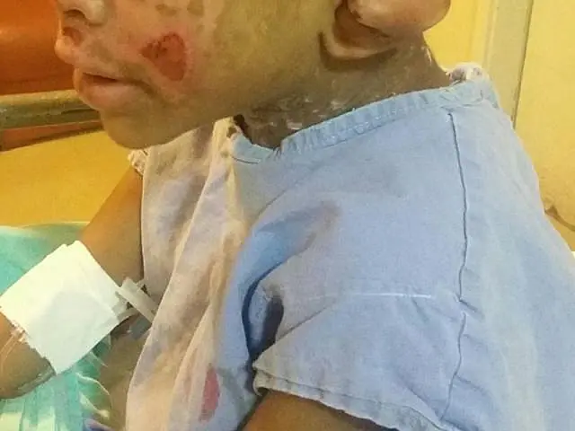 Tios torturam criança de 4 anos e culpam 'vozes do diabo'