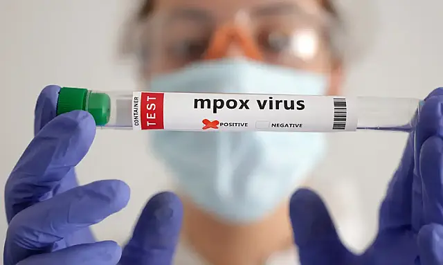 OMS: África soma quase 30 mil casos suspeitos de mpox este ano
