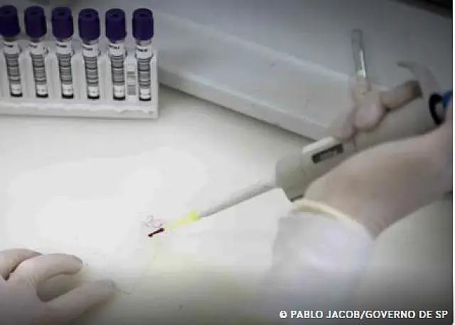 Paciente em SP com suspeita de ebola testa positivo para meningite