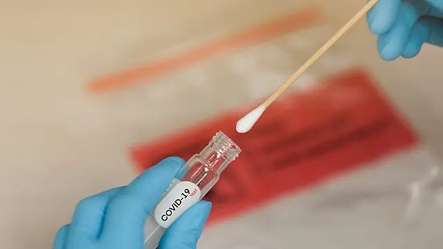 Aquidauana fecha semana com 75 novos casos de COVID-19