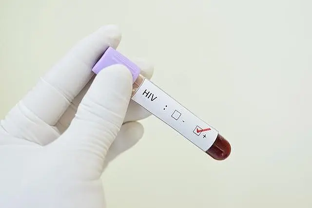 Jovens podem realizar testes de HIV e ISTs gratuitamente em MS