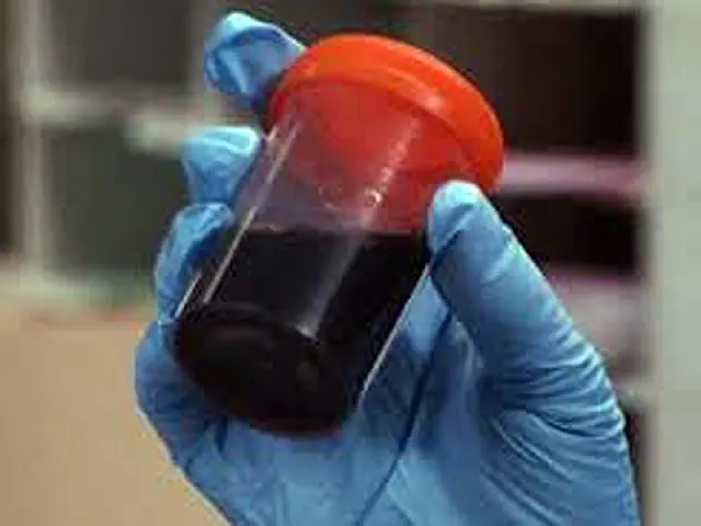 Consumo de peixe causou 'doença da urina preta', diz estudo
