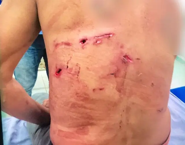 Homem atacado por onça-pintada é salvo por 5 cachorros em MS