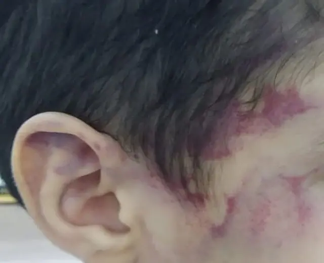 Lutador de muay thai é suspeito de espancar e torturar enteado de 5 anos