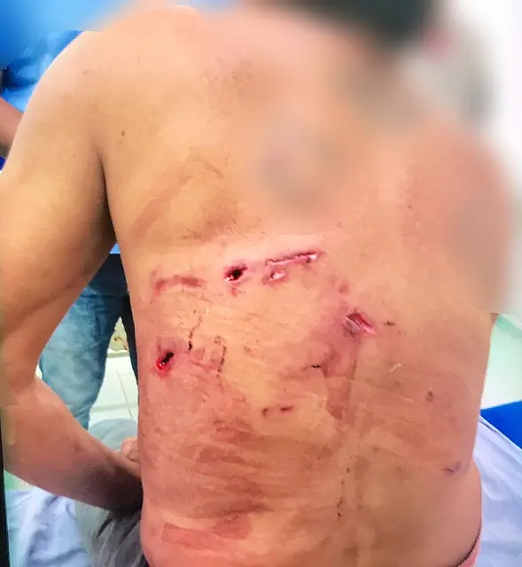Atacado por onça em fazenda perdeu sangue e chegou a ficar tonto; foi salvo por cães
