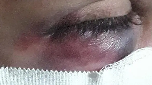 'Socorro, ele vai me matar', grita mulher que era espancada por marido que acaba preso