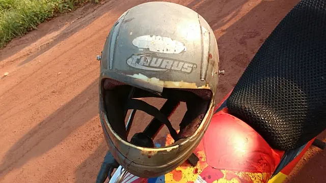 Jovem perde os dentes após "capacetadas" do marido