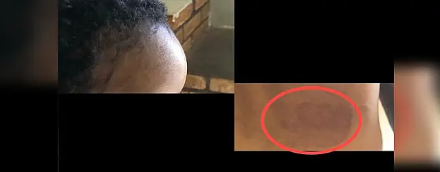 Mãe confessa que bateu em menino de três anos e é indiciada por maus-tratos
