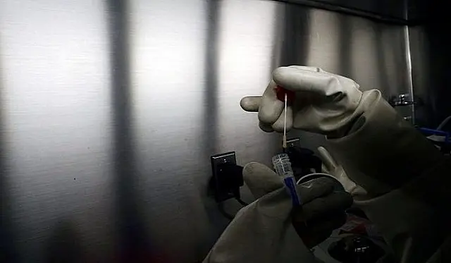 Casos novos de Covid disparam e média móvel atinge maior patamar da pandemia
