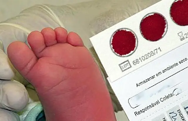 União anuncia R$ 30 milhões para ampliação do teste do pezinho