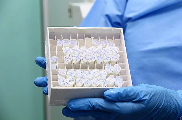 Fiocruz cria insumo nacional para uso no teste rápido da leishmaniose visceral
