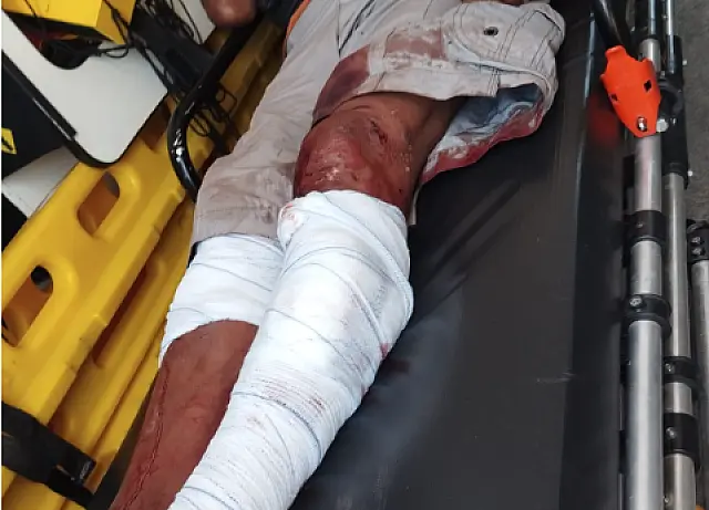 Homem é atacado por cães e fica ferido no bairro Flamboyant em Corumbá