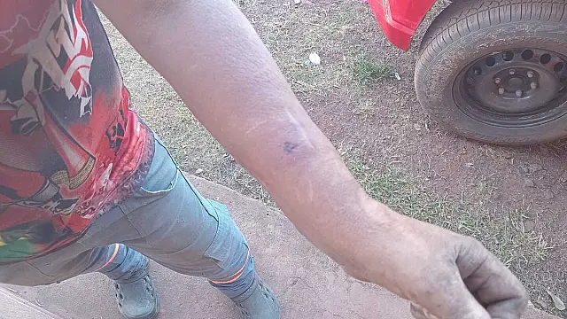 Bombeiros atendem trabalhador rural picado por jararaca em Corumbá
