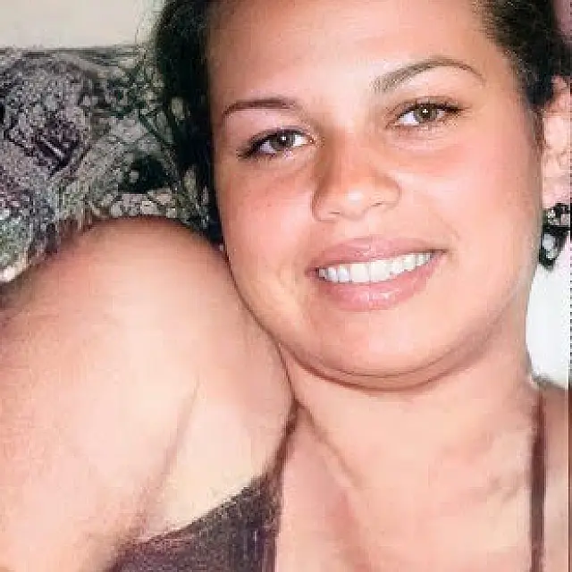 Moradora de Aquidauana morre após infecção de dermatite