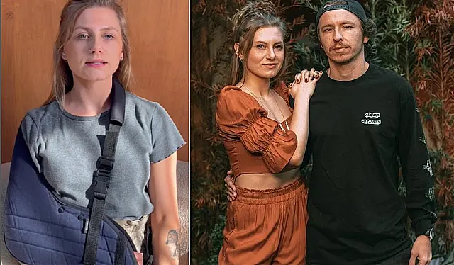 Comediante alemã que visitou Aquidauana denuncia marido por agressão