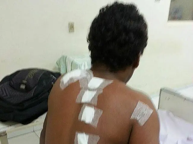 Após seis dias, turista esfaqueado 13 vezes recebe alta em Aquidauana