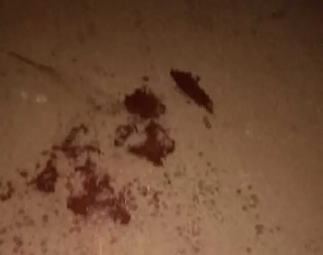Durante a madrugada, homem é assassinado com 3 tiros