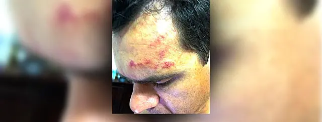Motorista de Van atropela ciclista na BR-262 e foge sem prestar socorro